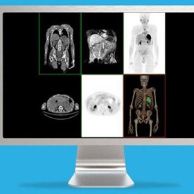 3D Imaging System | Volume Viewer