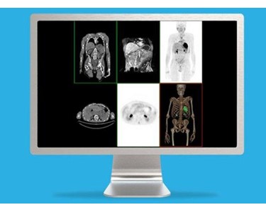 GE Healthcare - 3D Imaging System | Volume Viewer