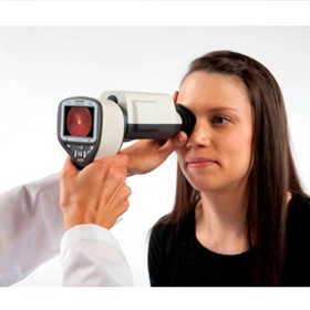Imaging Retinal Camera | Smart Scope Pro