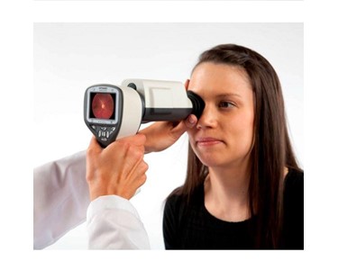 Optomed - Imaging Retinal Camera | Smart Scope Pro