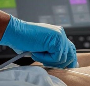 An Introduction to VExUS - Venous Excess Ultrasound Exam An Introduction to VExUS - Venous Excess Ultrasound Exam