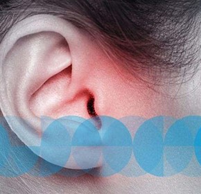 Top Features In Tinnitus-Treating Devices Top Features In Tinnitus-Treating Devices