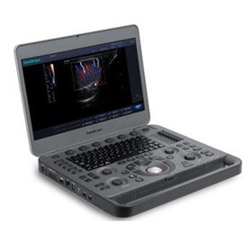 X5 real-time portable Colour Doppler Laptop Ultrasound Machine