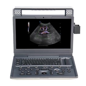 V9 Lite Digital Color Doppler Veterinary Ultrasound Imaging System 