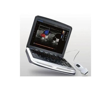 Chison - Portable Ultrasound Scanner Colour Doppler, Laptop | SonoBook