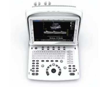 Chison - Portable Ultrasound Machine | ECO3 Expert
