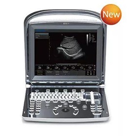 Portable Ultrasound Machine | ECO1 