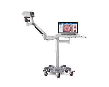 High Definition Gynaecology Colposcopes | C6A