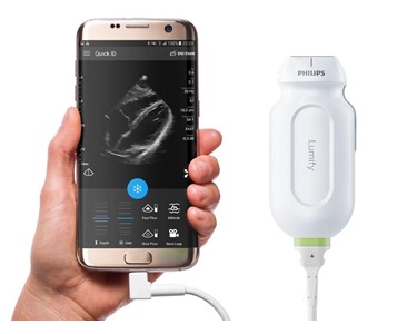 Philips Lumify - Point of Care Ultrasound 