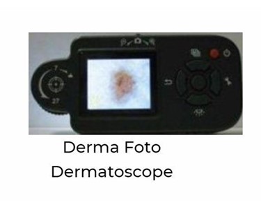 Derma Foto Dermatoscope | Emech