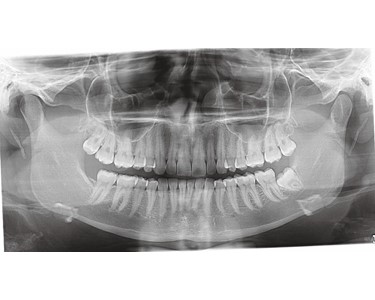 KaVo - Dental OPG X-Ray Machine | OP 2D
