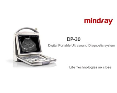 Mindray - Digital Portable Ultrasound System | DP-30
