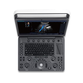 Portable Ultrasound System | E2