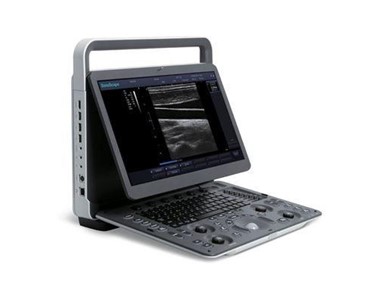 SonoScape - E1 Real Time Ultrasound Machine