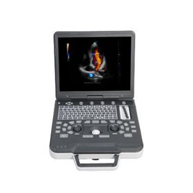Portable Ultrasound Machine | Apogee 1000 Pro