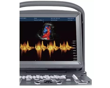 Chison - Vet Ultrasound Machines | ECO6