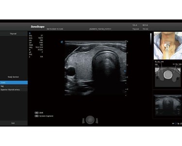 SonoScape - P25 Elite Ultrasound System from Innologic 