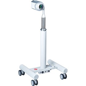 Mobile Gynaecology Colposcope ViCo
