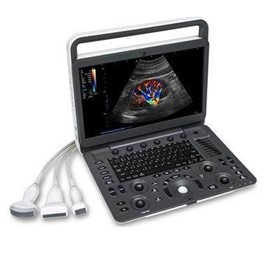 E2 Premium Colour Doppler Portable Ultrasound Scanner