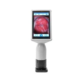 Gynaecology Colposcope | EVA Pro Mobile Digital