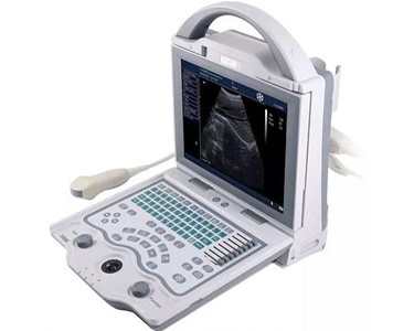 Full Digital Portable Ultrasound Machine | KX5600v