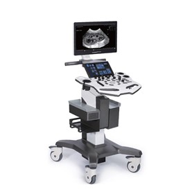Ultrasound Machine | VINNO E10