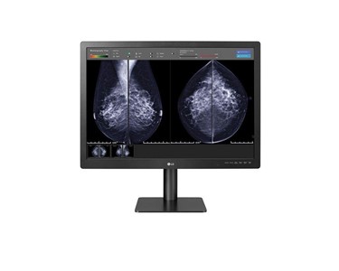 LG - Diagnostic Medical Monitor for Mammography | 31'' 12MP  | 31HN713D-B 