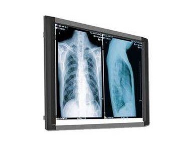 Ultrasound Accessories & X-Ray Accessories | AMS
