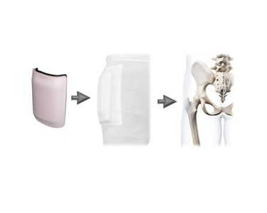 Pelican - Homecare & Consumer Medical | Hip Protector Pads & Pants