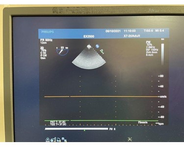 Philips - Ultrasound Probe | X7-2t TEE 