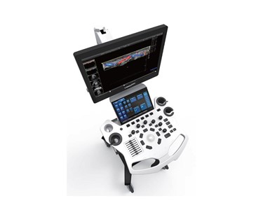 Ultrasound Machine | VINNO E20