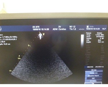 GE - Ultrasound Machine | Vivid 7 Dimension