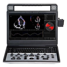 Portable Ultrasound Machine | Apogee C5  