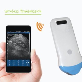 Wireless Ultrasound Scanner | Micro Convex Series