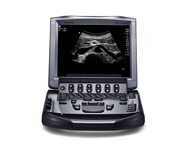 Sonosite - Veterinary Ultrasound Machine | M-Turbo