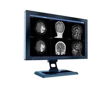 Sectra - 2D Imaging Systems | Anatomical Linking