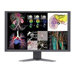 Healthcare IT | Synapse® 3D CV