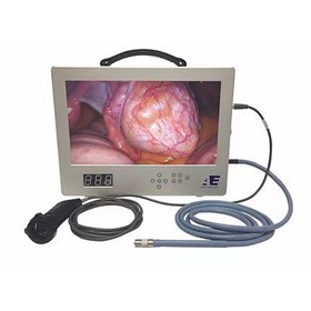 All-in-One Medical Portable Video Endoscopic System (AE-1080 HD)
