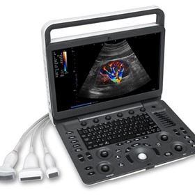 E2V Veterinary Colour Doppler Portable Ultrasound Machine Scanner