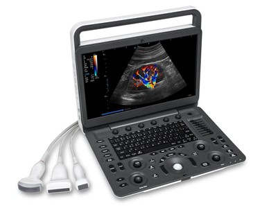 SonoScape - E2V Veterinary Colour Doppler Portable Ultrasound Machine Scanner