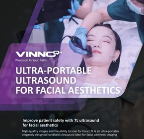 Handheld Ultrasound | Q+ | Portable 