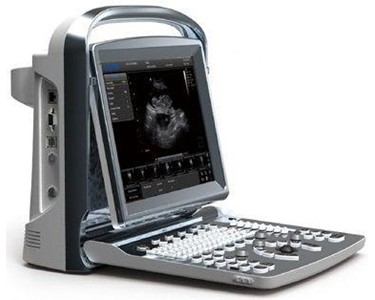 Chison - Portable Ultrasound Machine | ECO1 
