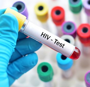 HIV testing key to ending transmission HIV testing key to ending transmission
