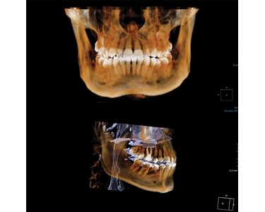 Dexis - Dental 3D Imaging System | OP 3D 