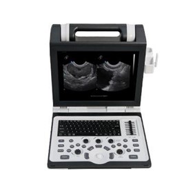 Portable Ultrasound Machine | Apogee 2300 Pro