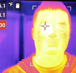 Thermal Imaging for Detecting Elevated Body Temperature Thermal Imaging for Detecting Elevated Body Temperature