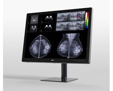 LG - Diagnostic Medical Monitor for Mammography | 31'' 12MP  | 31HN713D-B 