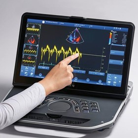 Portable Ultrasound Scanner | Vivid iq