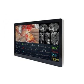 27″ 4K Medical Display |  WM-27-4K