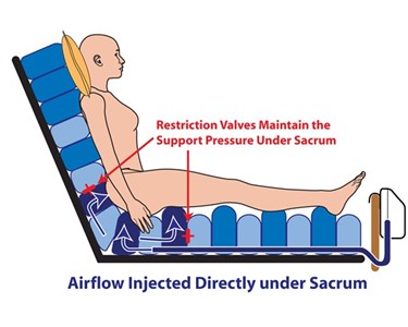 Air Alternating Overlay | Theraflow5 | Direct Sacral Therapy